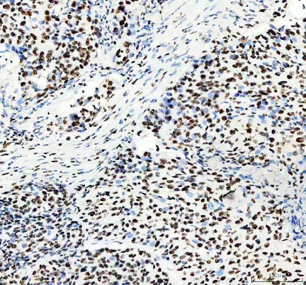 a02726 1 hnrnpc primary antibodies ihc testing 4