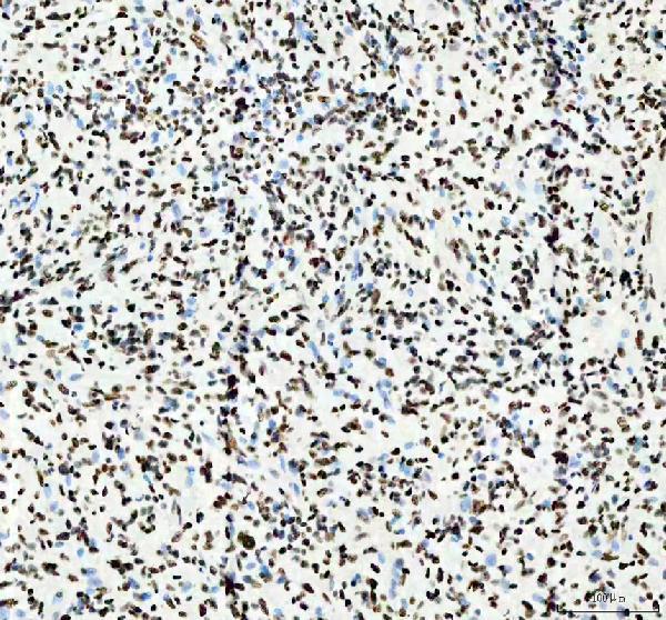 a02726 1 hnrnpc primary antibodies ihc testing 5