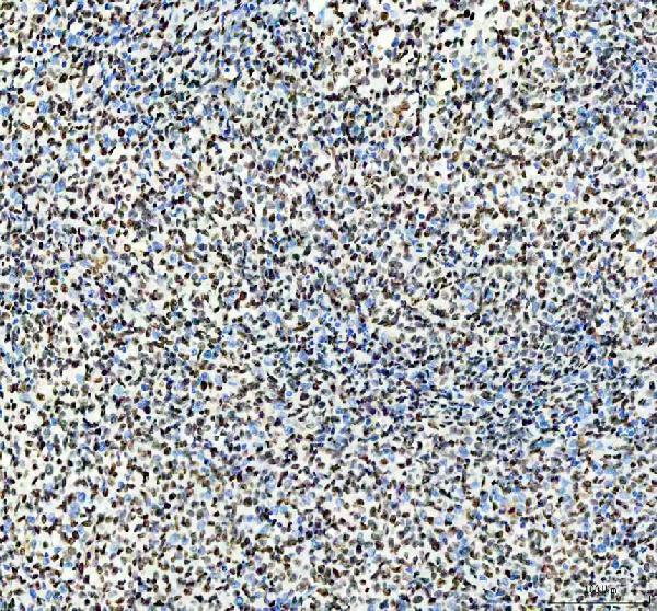 a02726 1 hnrnpc primary antibodies ihc testing 6