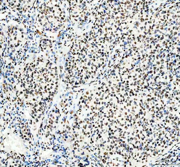a02726 1 hnrnpc primary antibodies ihc testing 7