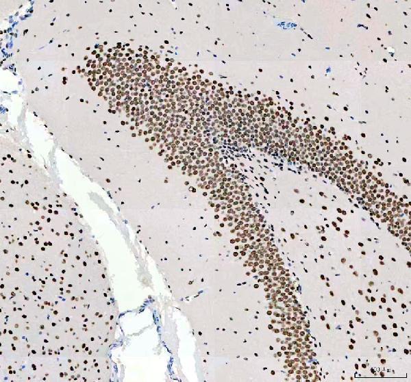 a02726 1 hnrnpc primary antibodies ihc testing 8