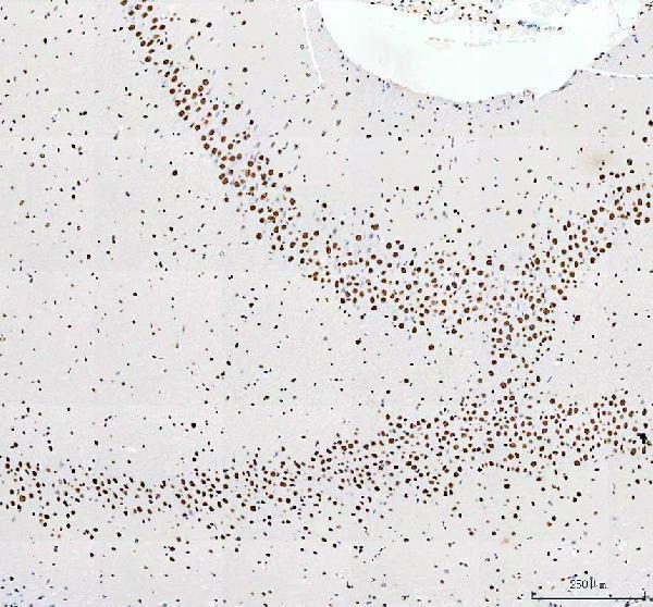 a02726 1 hnrnpc primary antibodies ihc testing 9