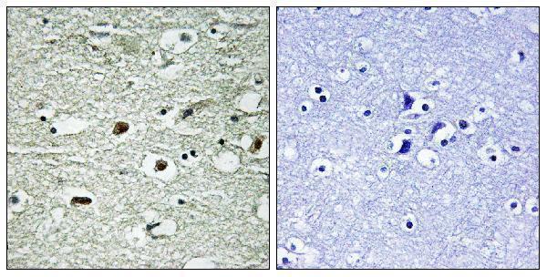 a02726s260 hnrnpc primary antibodies ihc testing 1