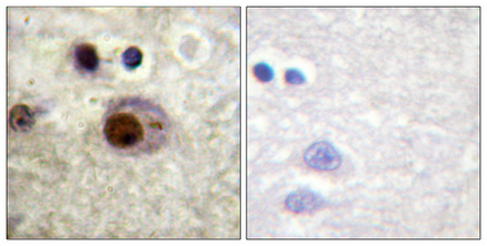 a02726s260 hnrnpc primary antibodies ihc testing 4