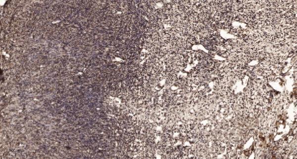 Immunohistochemical analysis of paraffin-embedded human oophoroma