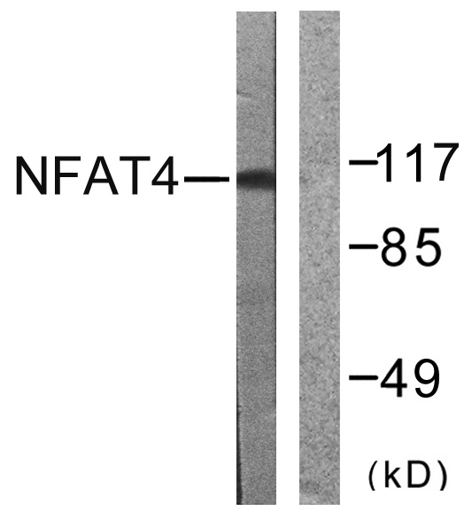 Western blot analysis of lysates from HeLa cells, treated with Ca+ 40nM 30