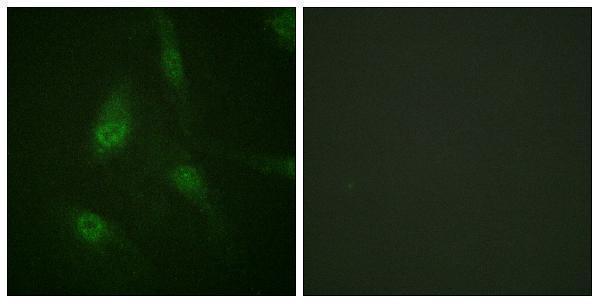 Immunofluorescence analysis of HeLa cells, using NFAT4 (Phospho-Ser165) Antibody