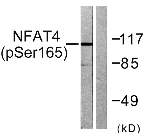 Western blot analysis of lysates from HeLa cells treated with Ca+ 40nM 30', using NFAT4 (Phospho-Ser165) Antibody