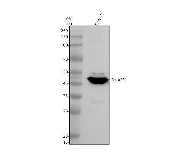 Western blot analysis of DNase I/DNASE1 using anti-DNase I/DNASE1 antibody (A02728-1)