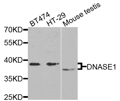 Western blot analysis of extracts of various cell lines, using DNASE1  antibody  at 1:1000 dilution