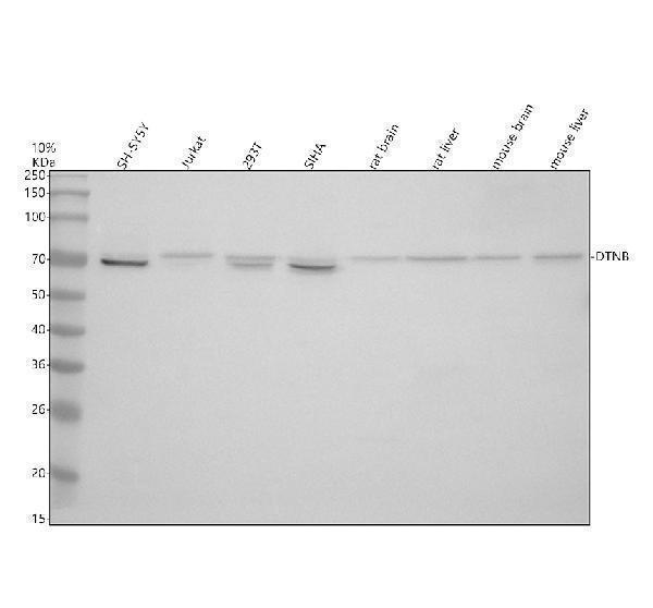 Western blot analysis of DTNB using anti-DTNB antibody (A02729-2)