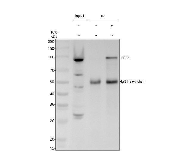 Immunoprecipitating EPS8 in A549 whole cell lysate
