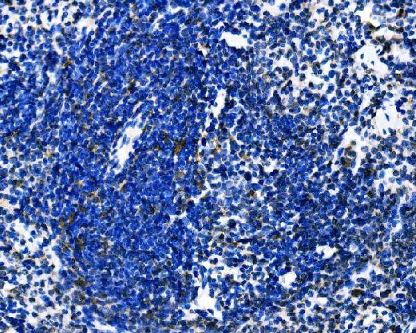  IHC analysis of Dectin-1/Clec7a using anti-Dectin-1/Clec7a antibody (A02731-1)