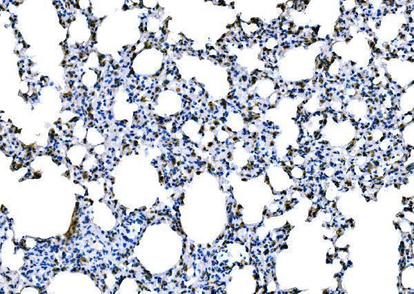  IHC analysis of Dectin-1/Clec7a using anti-Dectin-1/Clec7a antibody (A02731-1)