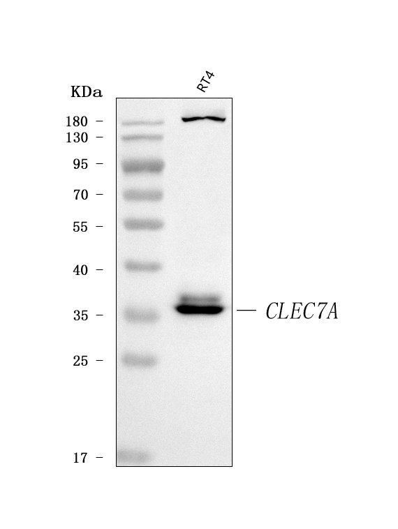  Western blot analysis of Dectin-1/CLEC7A using anti-Dectin-1/CLEC7A antibody (A02731-2)