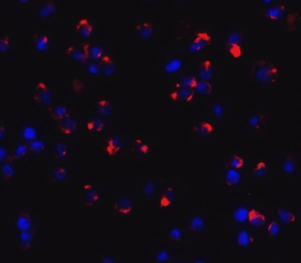 Immunofluorescence of CLEC7A in Jurkat cells with CLEC7A antibody at 20 μg/mL