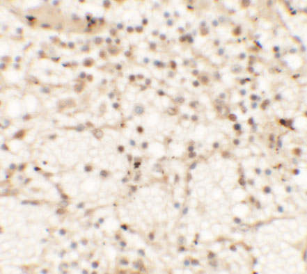 Immunohistochemistry of CLEC7A in human spleen tissue with CLEC7A antibody at 5 μg/mL