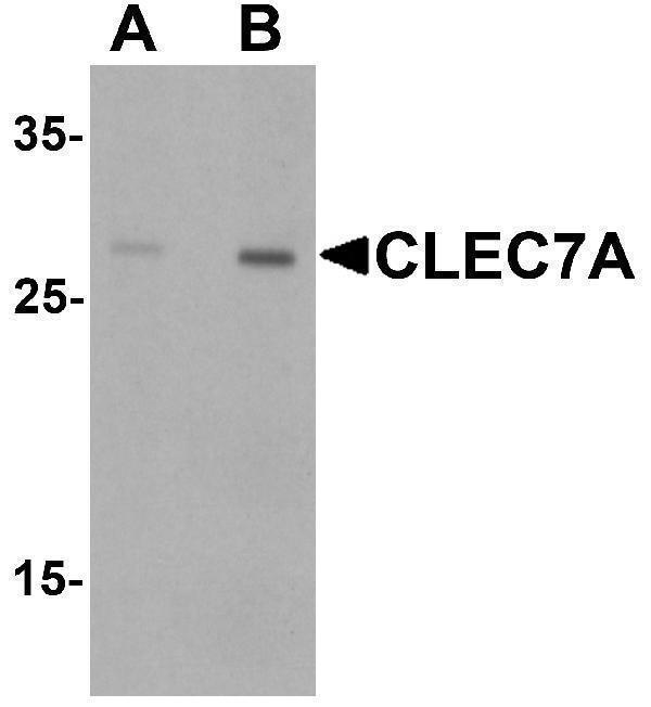 Western blot analysis of CLEC7A in rat spleen tissue lysate with CLEC7A antibody at (A) 1 and (B) 2 μg/mL