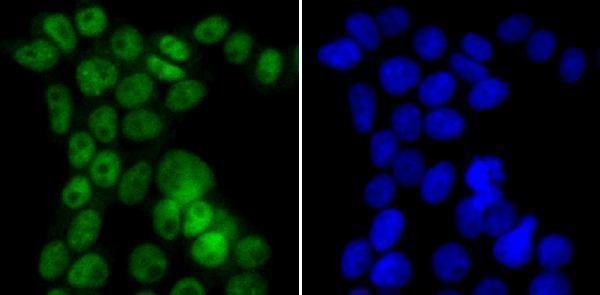 ICC staining p150 CAF1 in 293T cells (green)