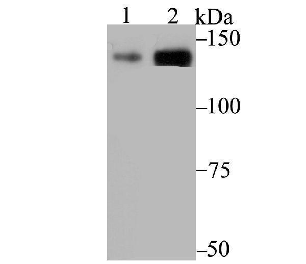 Western blot analysis of p150 CAF1 on K562 (1) and A431 (2) cell lysate using anti-p150 CAF1 antibody at 1/1,000 dilution