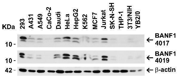 Independent Antibody Validation (IAV) via Protein Expression Profile in Human Lines
Loading: 15 μg of lysates per lane