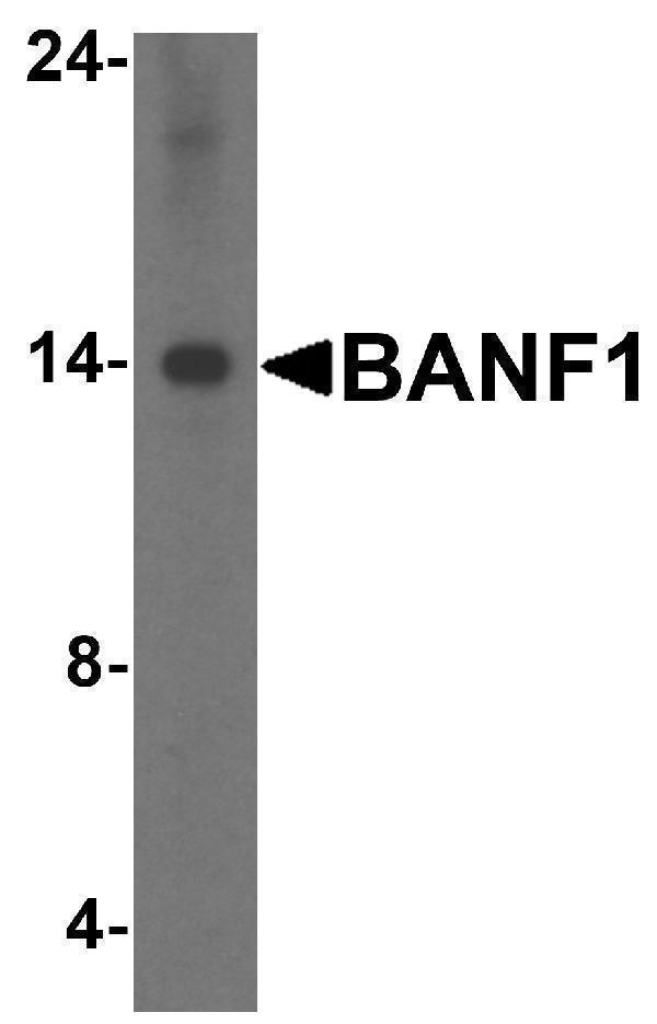 Western Blot Validation in HeLa Cell Lysate
Loading: 15 μg of lysates per lane