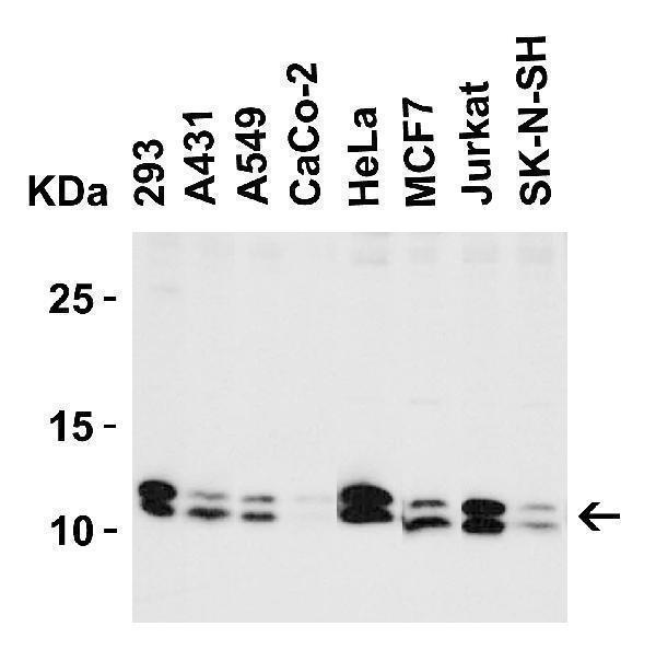 Western Blot Validation in Human Cell Lines
Loading: 15 μg of lysates per lane