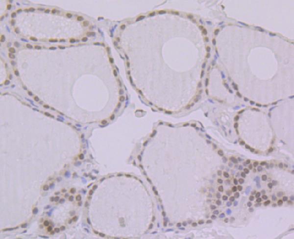 Immunohistochemical analysis of paraffin-embedded human thyroid gland tissue using anti-BANF1 antibody