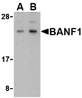 Western Blot Validation in Human Kidney Tissue Lysate
Loading: 15 μg of lysates per lane
