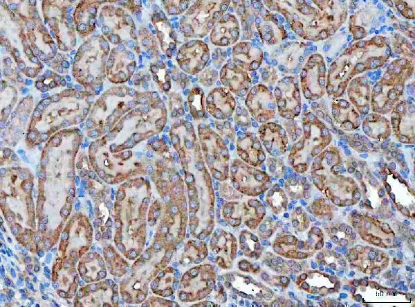  IHC analysis of Klk7 using anti-Klk7 antibody (A02739-1)