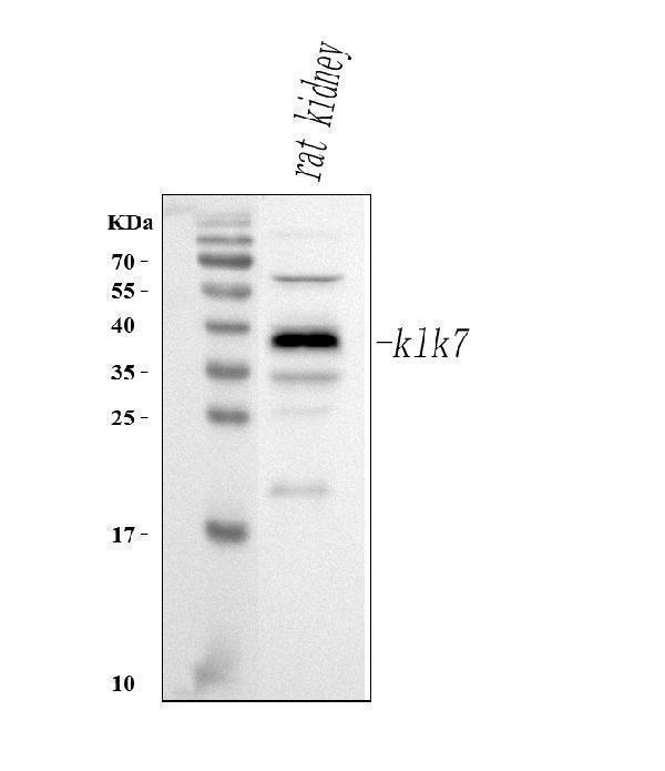  Western blot analysis of Klk7 using anti-Klk7 antibody (A02739-1)