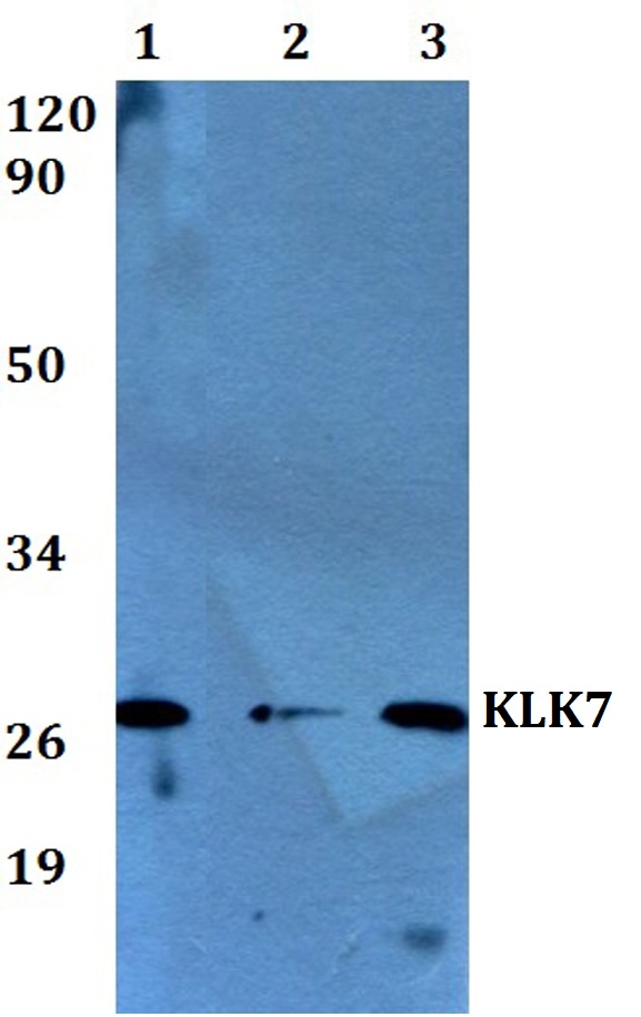 a02739 klk7 primary antiboties wb testing 1
