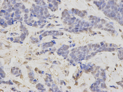 a02741 1 lig3 primary antiboties ihc testing 2
