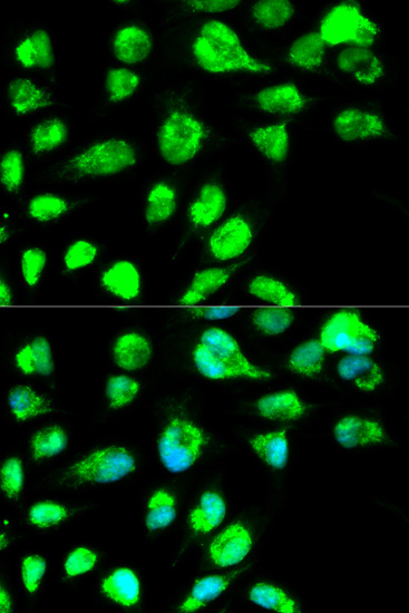 a02741 1 lig3 primary antiboties ihc testing 3