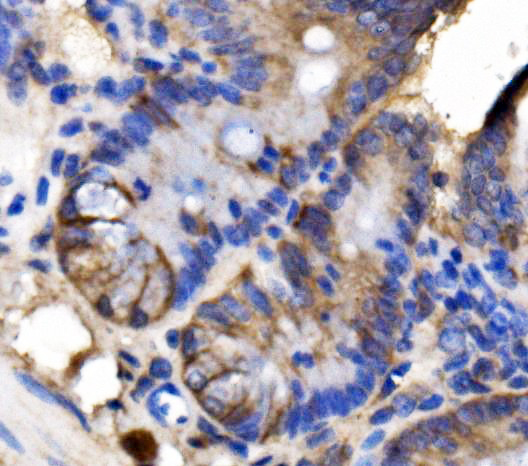 a02742 1 lsr primary antibodies ihc testing 2