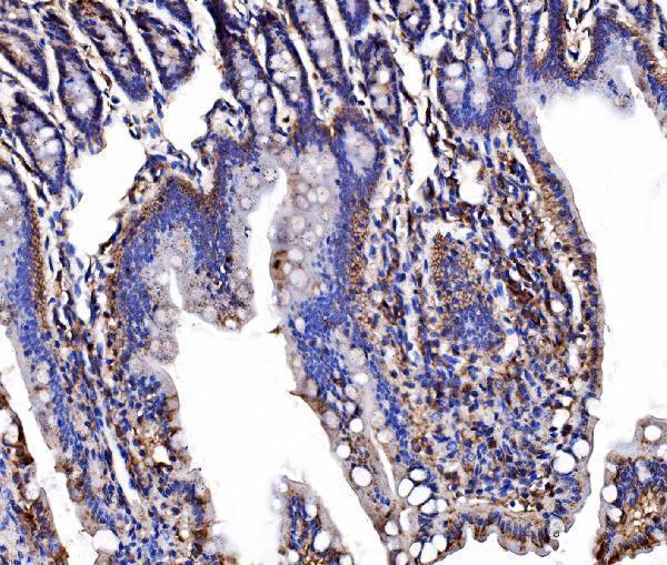 a02742 1 lsr primary antibodies ihc testing 3