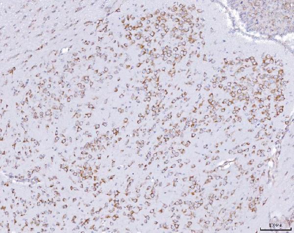  IHC analysis of PRKRA using anti-PRKRA antibody (A02744-2)