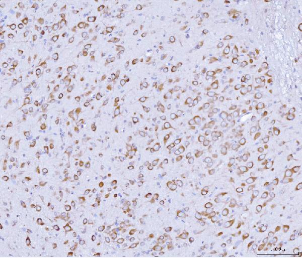 a02744 2 prkra primary antibodies ihc testing 3