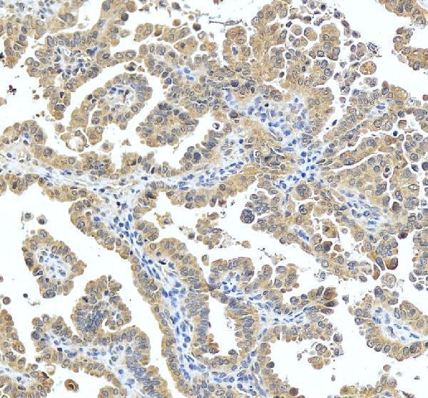 IHC analysis of PACT/PRKRA using anti-PACT/PRKRA antibody (A02744-2)