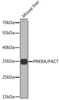 Western blot analysis of extracts of mouse liver, using PRKRA/PACT antibody  at 1:1000 dilution