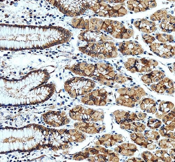 IHC analysis of CXADR using anti-CXADR antibody (A02747-1)