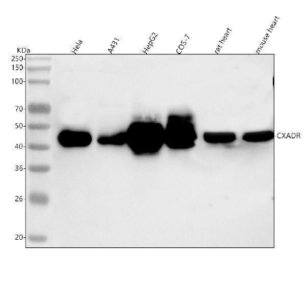  Western blot analysis of CXADR using anti-CXADR antibody (A02747-1)