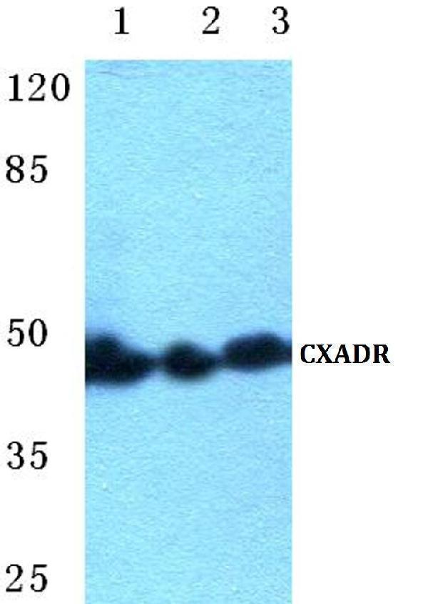 Western blot (WB) analysis of CXADR polyclonal antibody at 1:500 dilution
Lane1:Hela cell lysate
Lane2:NIH-3T3 cell lysate
Lane3:H9C2 cell lysate