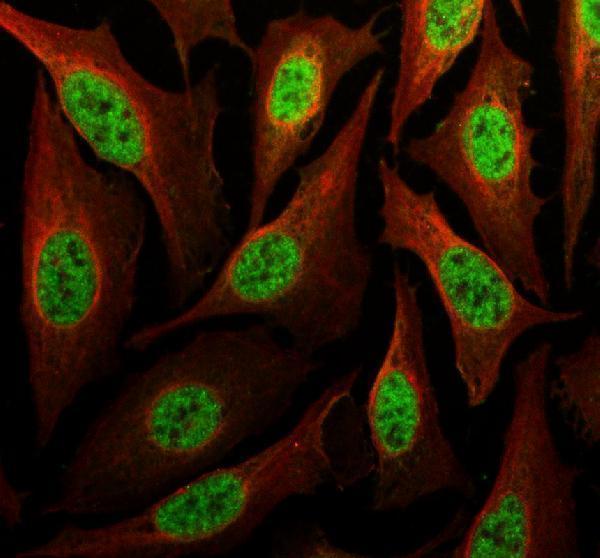 a02748 2 poldip3 primary antibodies if testing 1