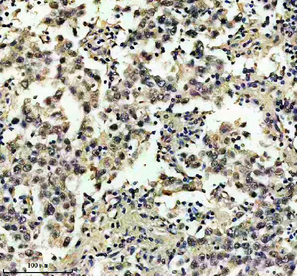 IHC analysis of SKAR/POLDIP3 using anti-SKAR/POLDIP3 antibody (A02748-2)