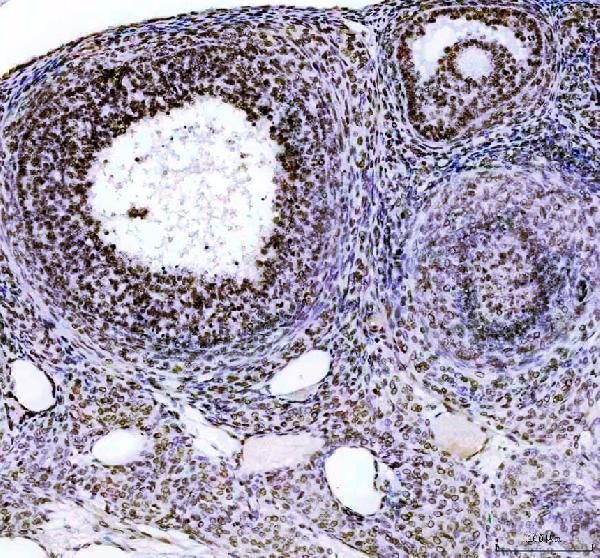 IHC analysis of SKAR/POLDIP3 using anti-SKAR/POLDIP3 antibody (A02748-2)