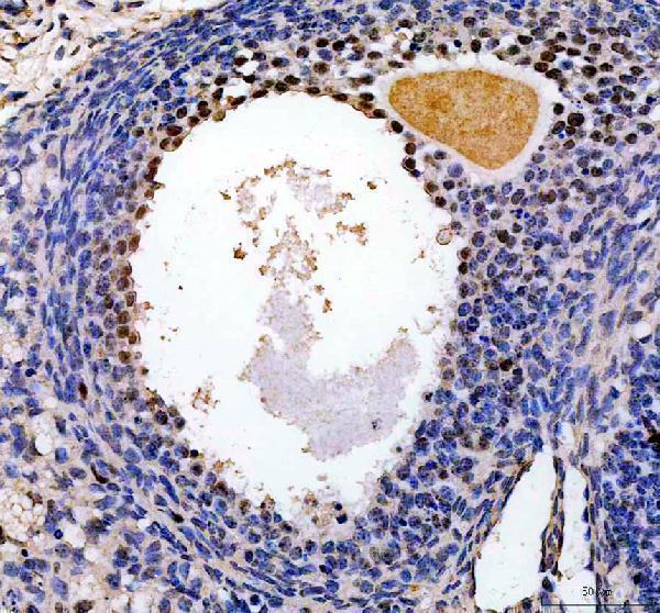 a02748 2 poldip3 primary antibodies ihc testing 3