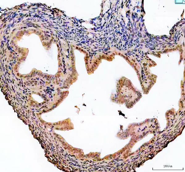 a02748 2 poldip3 primary antibodies ihc testing 4