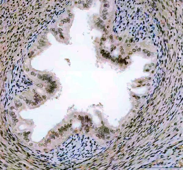 a02748 2 poldip3 primary antibodies ihc testing 5