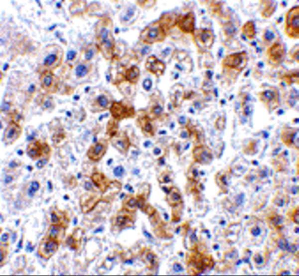 Immunohistochemistry of SCO2 in human liver tissue with SCO2 antibody at 2